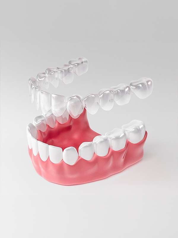 Clear Aligners Invisalign Sharjah | Discreet Teeth Straight